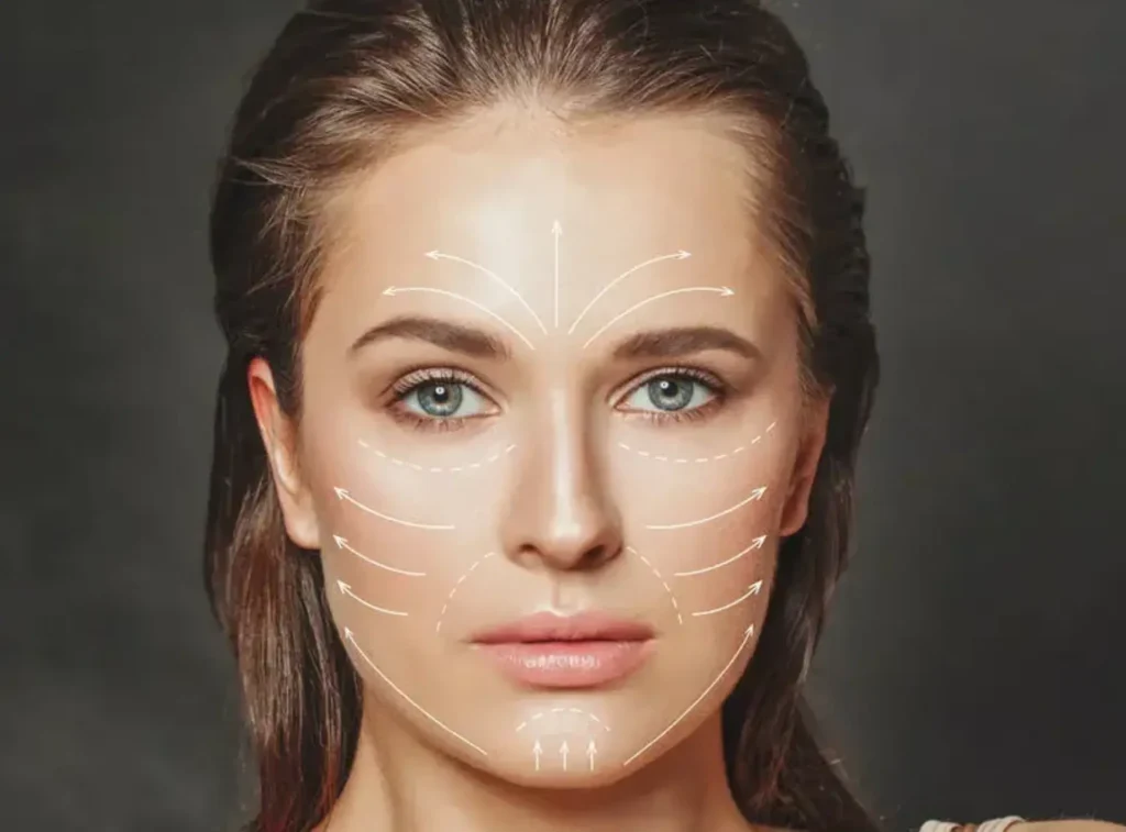 women with arrows showing her facial plastic surgery results
