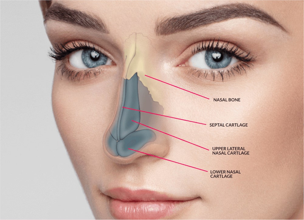 Rhinoplasty 