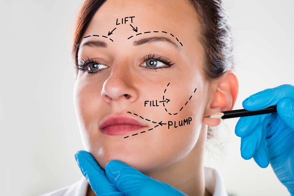 Facelift procedure Miami