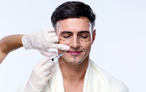 Facelift on a man