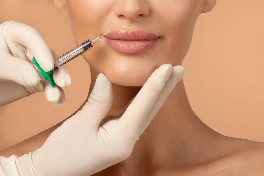 lip filler